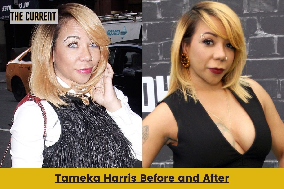 Tameka Harris Before and After