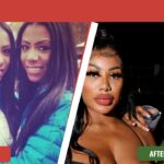 clermont twins before and after