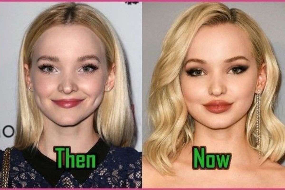dove cameron Before And After