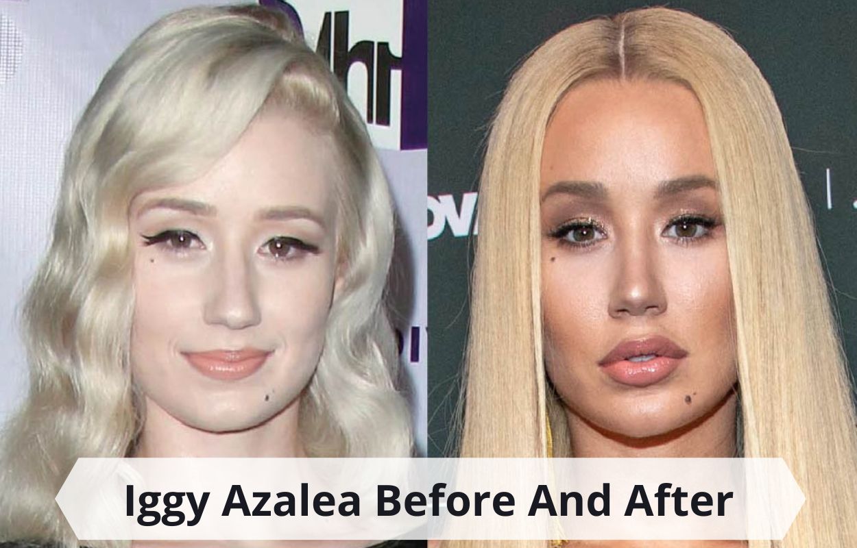 iggy azalea before & after