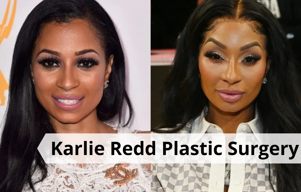 karlie redd plastic surgery