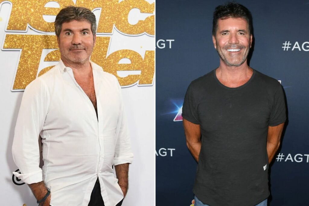 Simon Cowell Before And After Pictures What Happened With Simon Cowell?