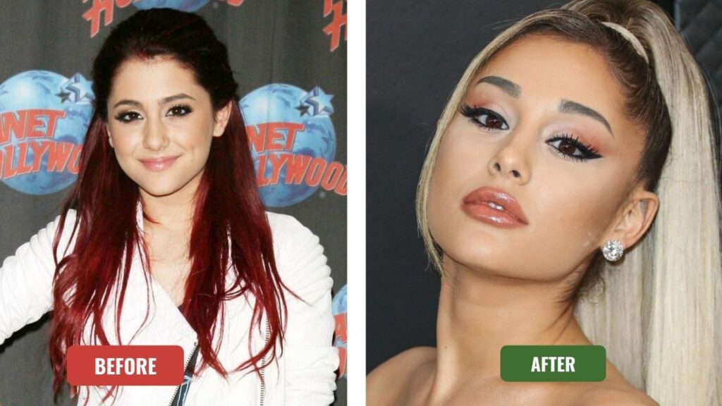 Ariana Grande before and after