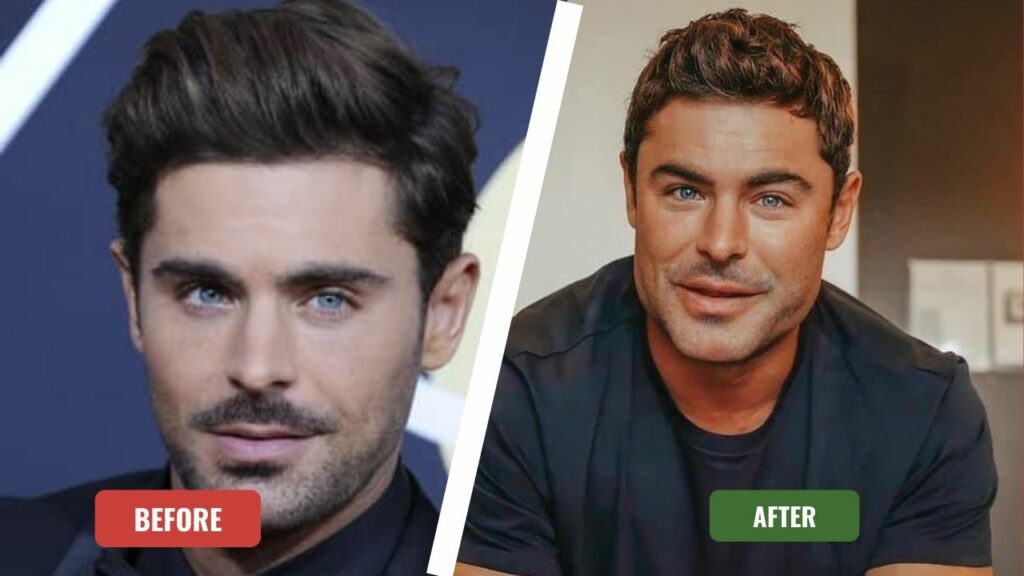 Finally, Zac Efron Is Talking About His Shocking Face Transformation