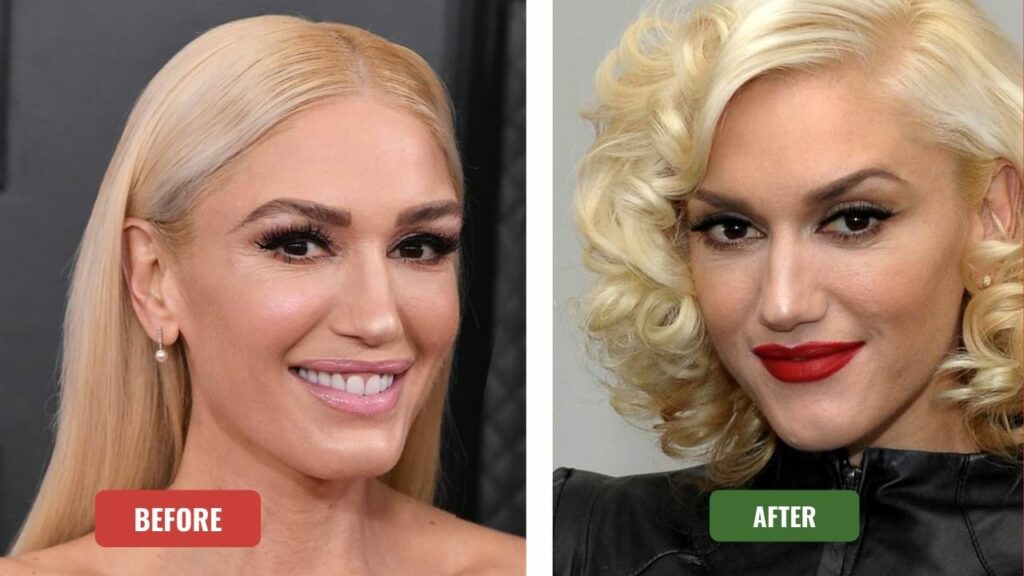 Gwen Stefani before & after