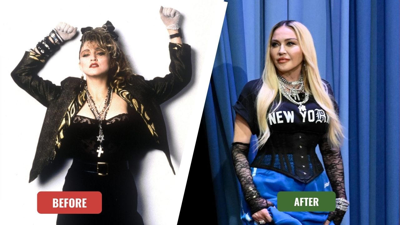 Madonna Before & After