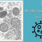 The First Monkeypox-related Death In The U.S