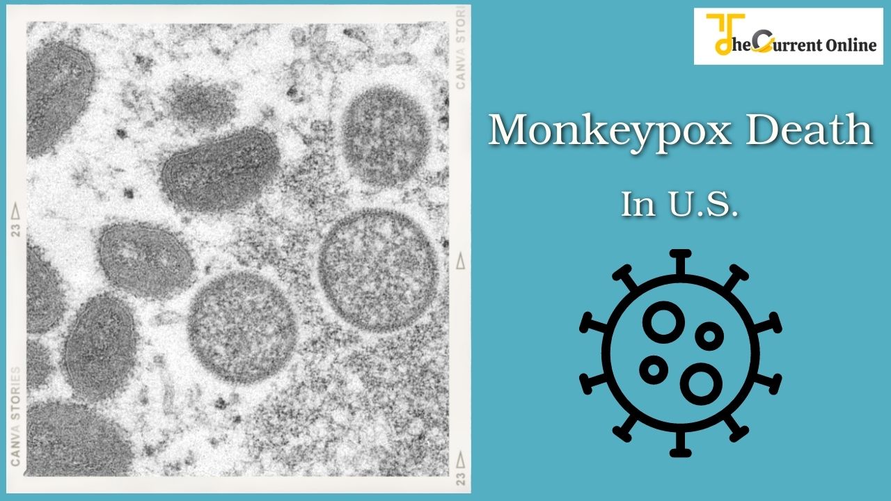 The First Monkeypox-related Death In The U.S