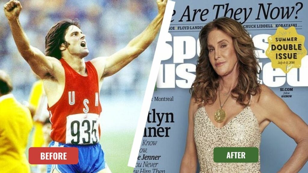 caitlyn jenner before and after