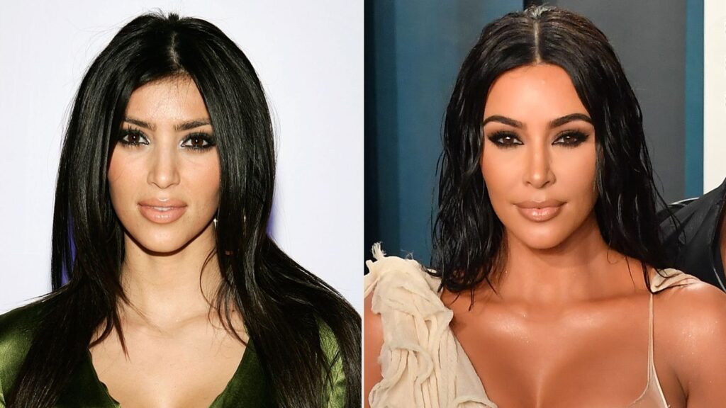 Kim Kardashian Before And After Plastic Surgery Pictures