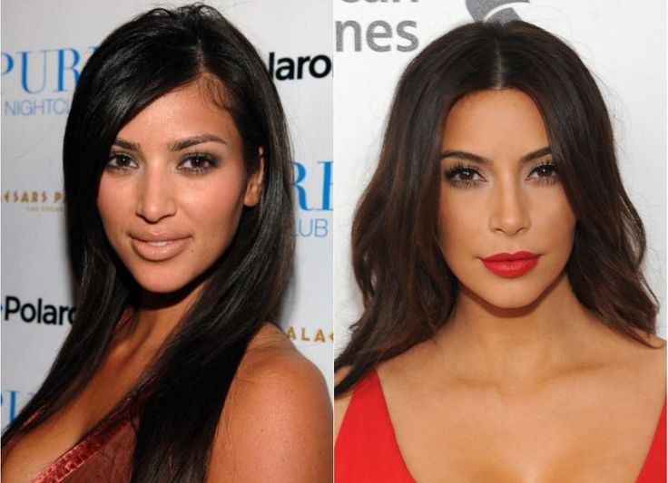 kim before and after 3