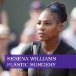 serena williams plastic surgery
