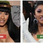 cardi b before and after teeth