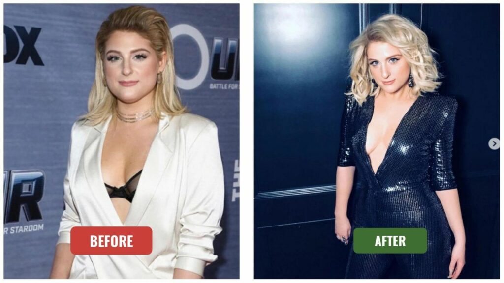 Meghan Trainor's Secret To Losing 20 Pounds Full Transformation Journey!
