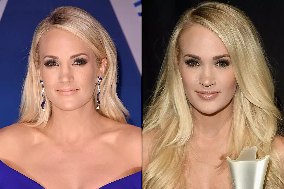 Carrie Underwood Before And After The Plastic Surgery!