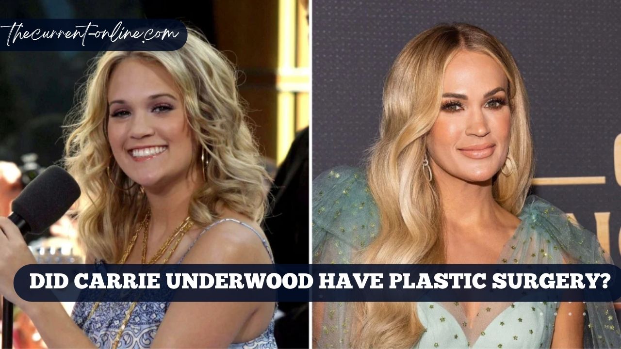 Did Carrie Underwood Have Plastic Surgery?