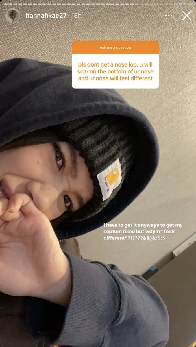 Hannah Kae's Instagram story on getting a nose job