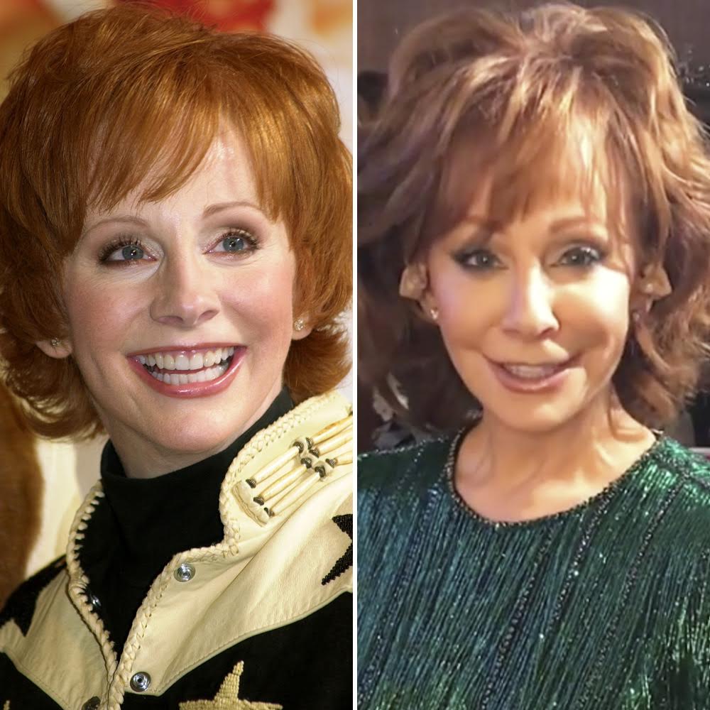 Reba Mcentire Facelift posted by Michelle Johnson