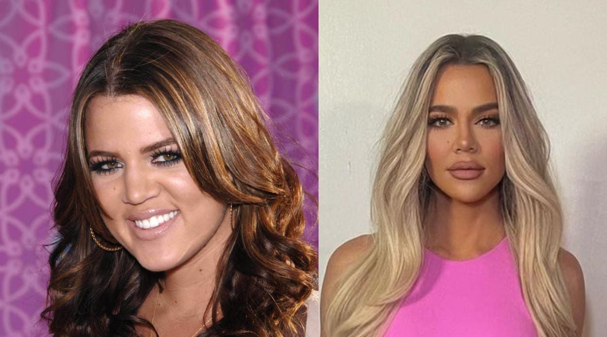 Khloe Kardashian Before & After Photos: Shocking Transformation