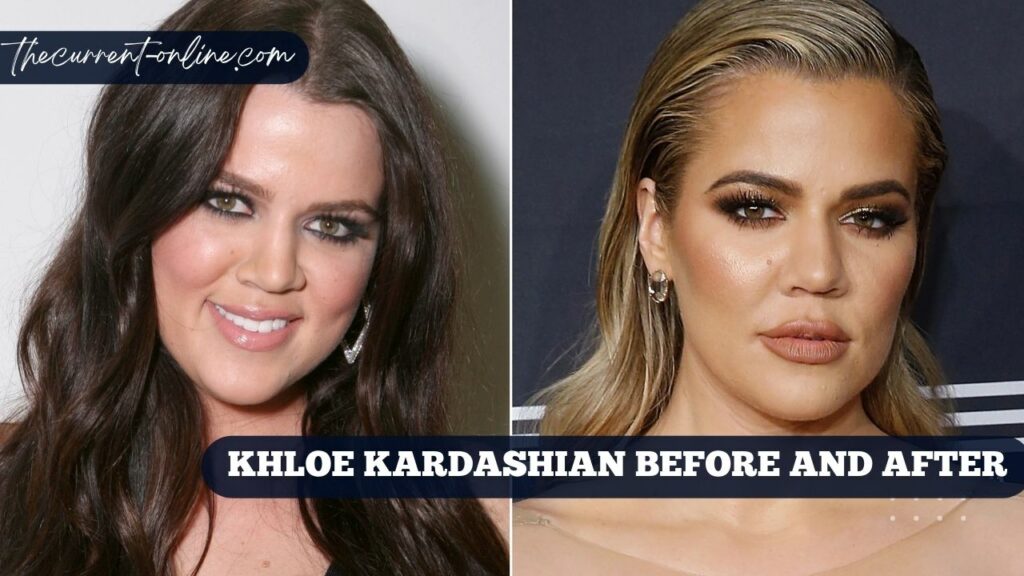 Khloe Kardashian Before And After