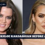 Khloe Kardashian Before And After