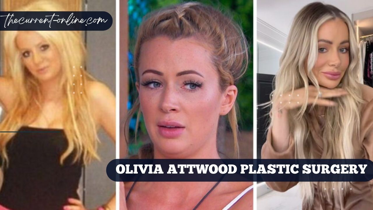 Olivia Attwood Plastic Surgery