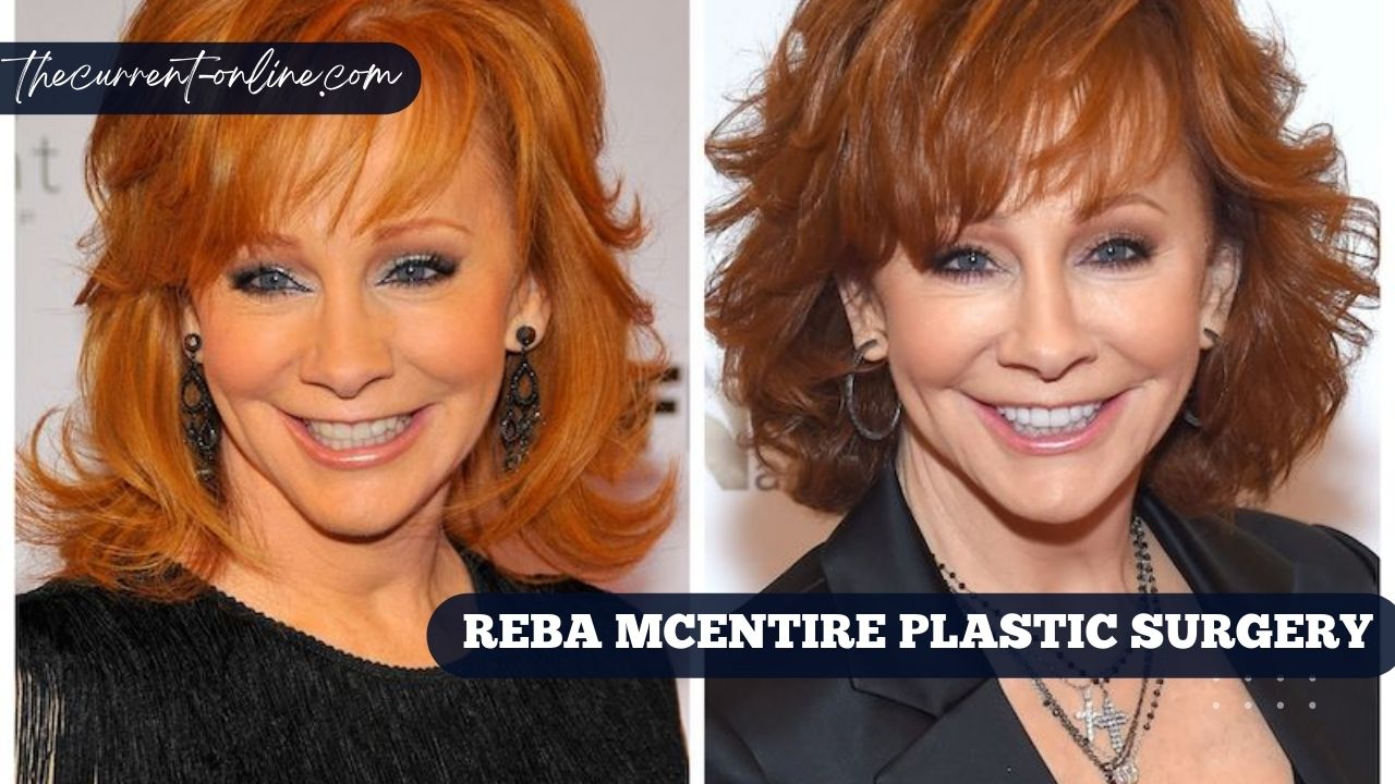 Reba Mcentire Plastic Surgery