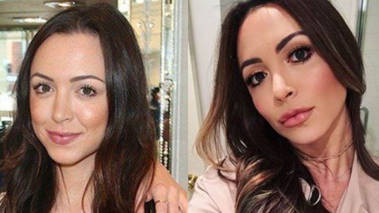 Farrah Brittany's Plastic Surgery: Kyle Richards' Daughter Sparks Cosmetic Surgery Rumors After Appearing in Buying Beverly