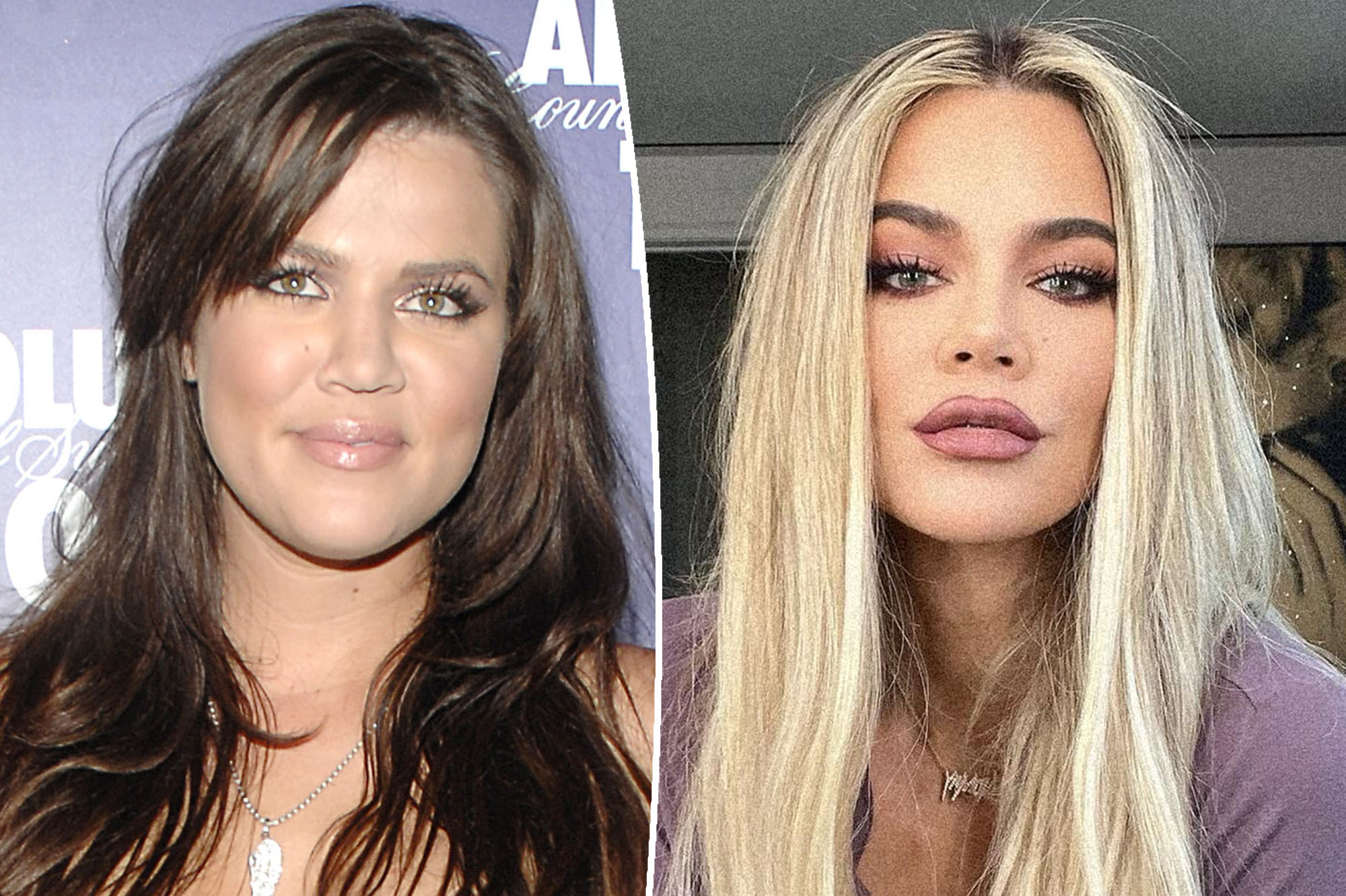 Khloé Kardashian addresses face transplant rumors