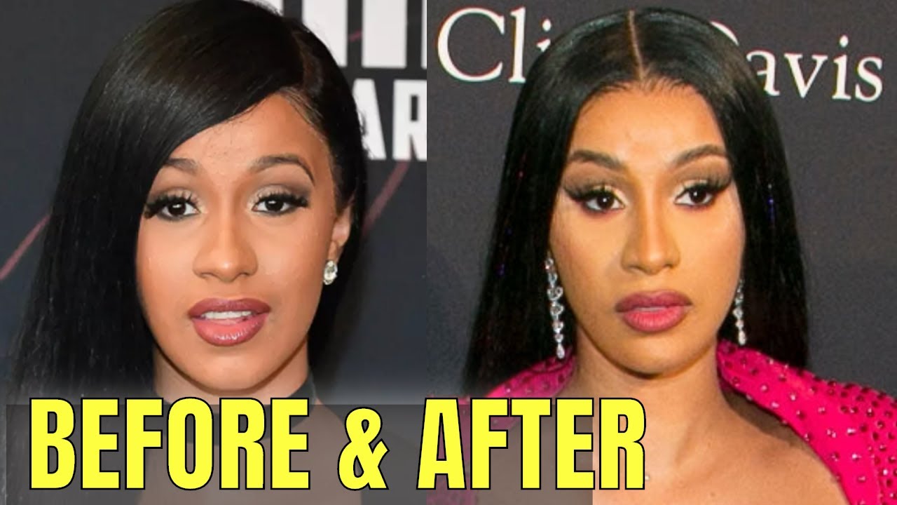 Cardi B: Plastic and Cosmetic Surgery - YouTube
