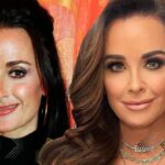 kyle richards before and after