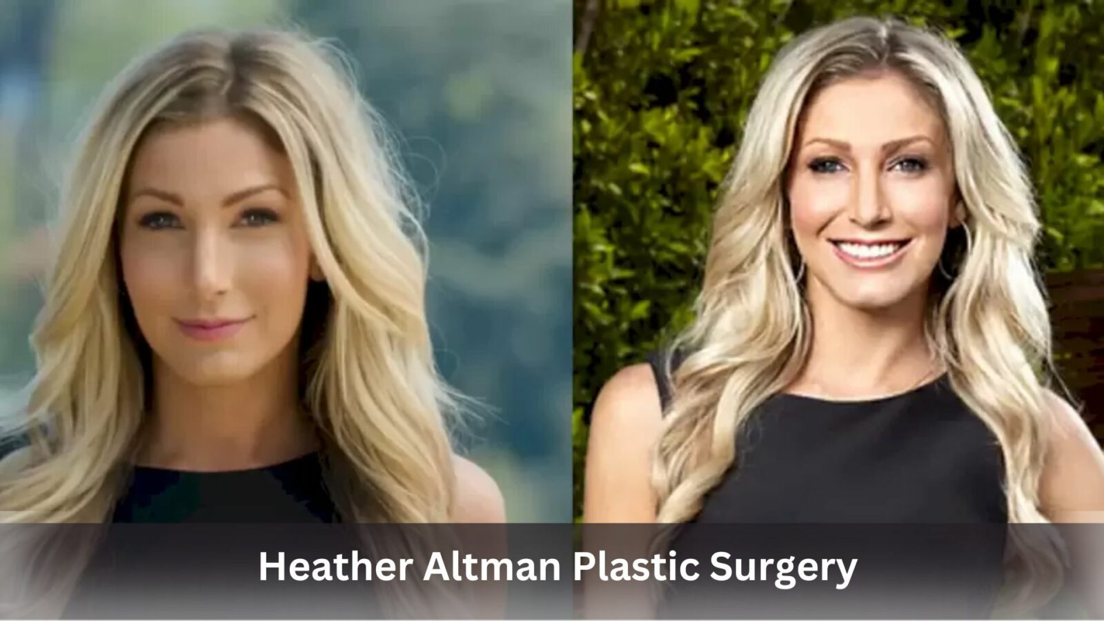 heather altman plastic surgery
