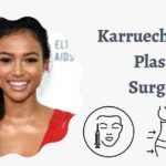 Karrueche Tran Plastic Surgery
