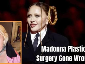 Madonna Plastic Surgery Gone Wrong