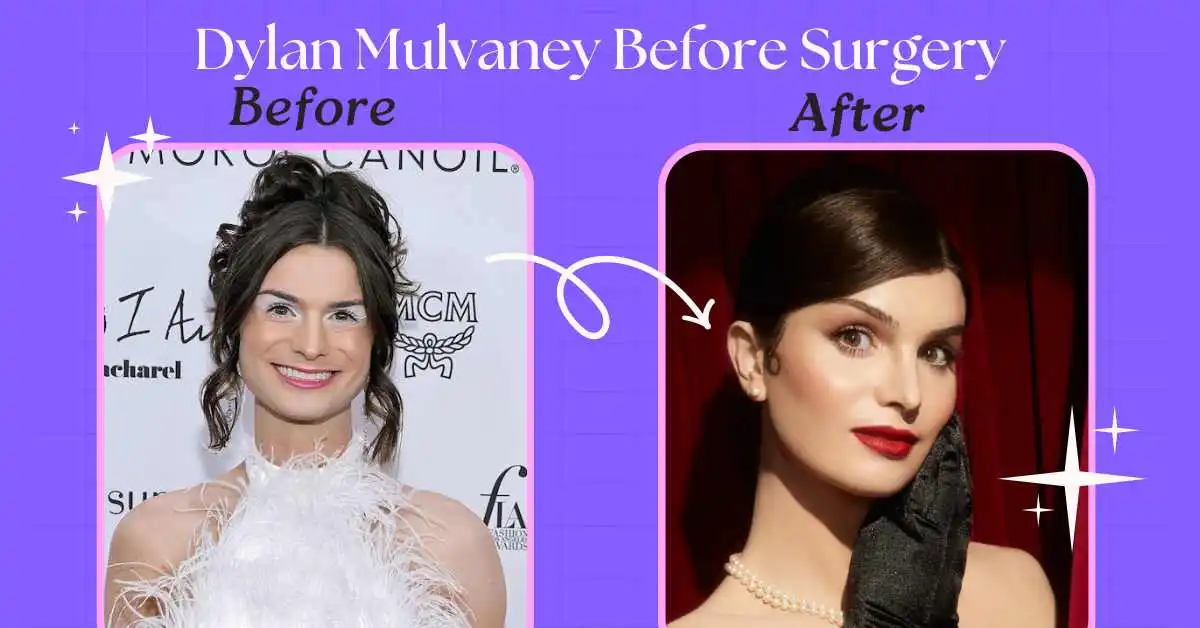 dylan mulvaney before surgery