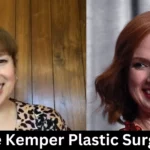 Ellie Kemper Plastic Surgery