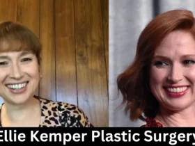 Ellie Kemper Plastic Surgery
