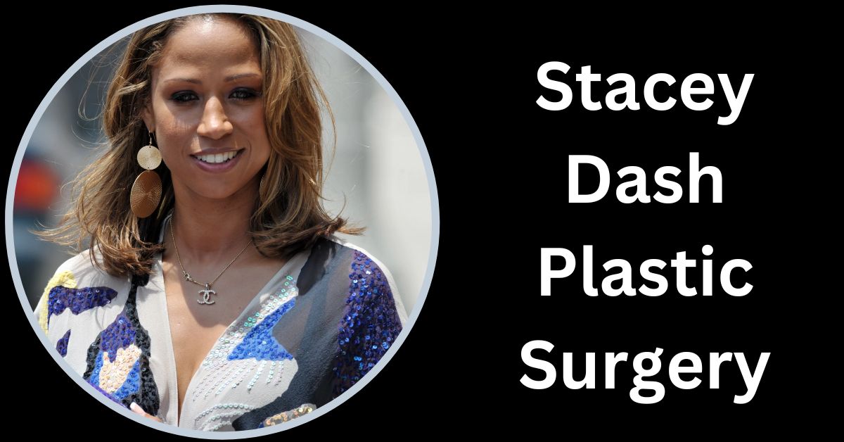 Stacey Dash Plastic Surgery