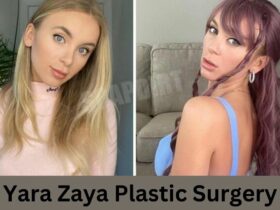 Yara Zaya Plastic Surgery