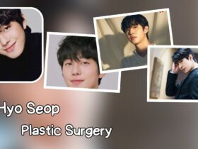 Ahn Hyo Seop Plastic Surgery