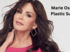 Marie Osmond Plastic Surgery