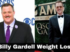 Billy Gardell Weight Loss Surgery