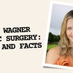 Jill Wagner Plastic Surgery