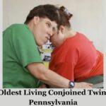 World's Oldest Living Conjoined Twins Died In Pennsylvania